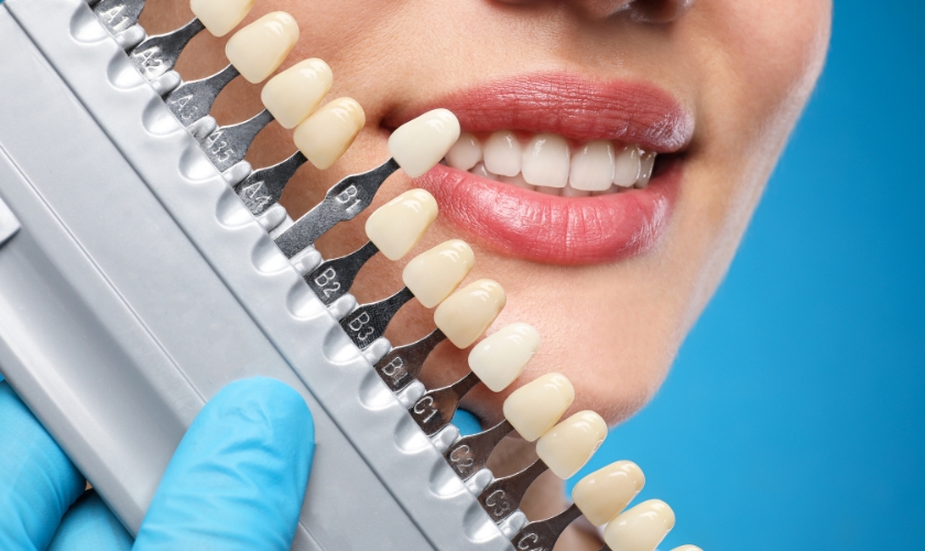 how enamel shaping can correct your teeth imperfections