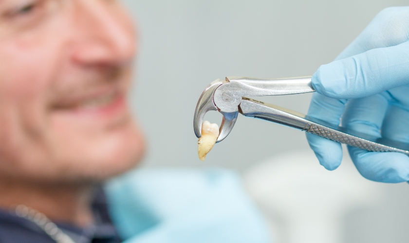 recommended not to take ibuprofen after a tooth extraction