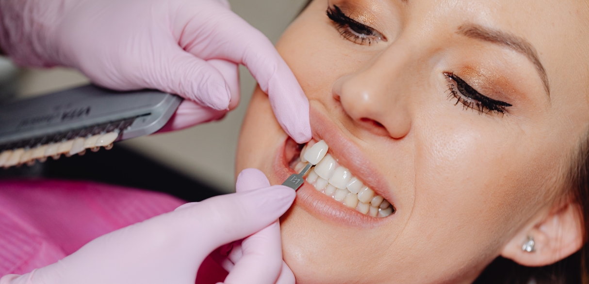 porcelain veneers fix stained or chipped teeth quickly