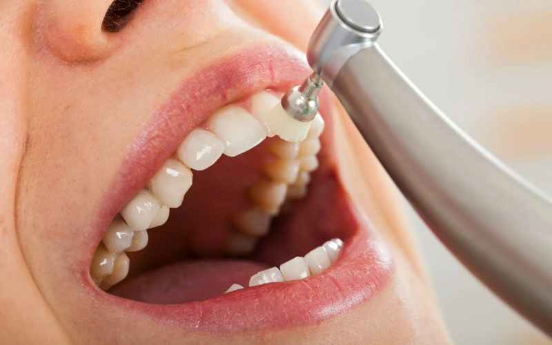 Benefits of deep cleaning